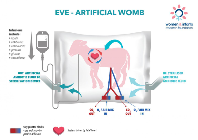The artificial womb system, “EVE,” used to incubate lambs. IMAGE: Women and Infants Research Foundation